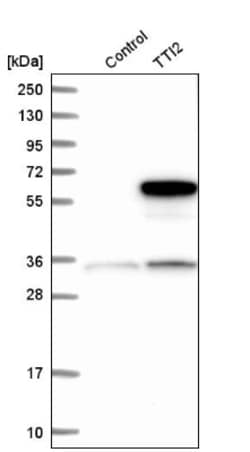 TTI2 Antibody, Novus Biologicals:Antibodies:Primary Antibodies